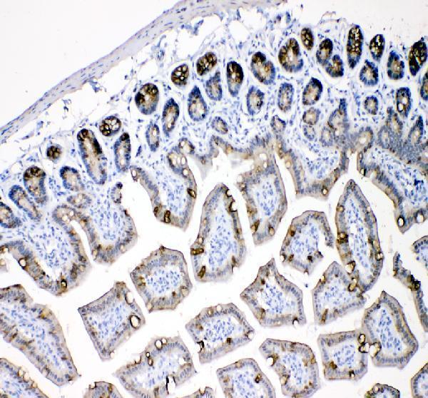 a01357 1 krt18 primary antibodies ihc testing 5