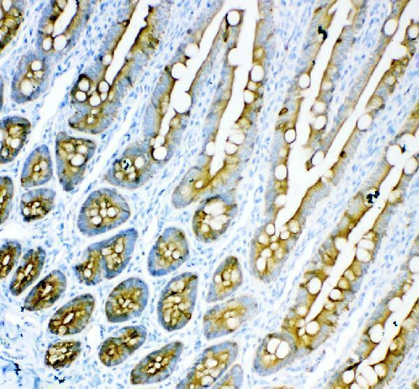 a01357 1 krt18 primary antibodies ihc testing 6