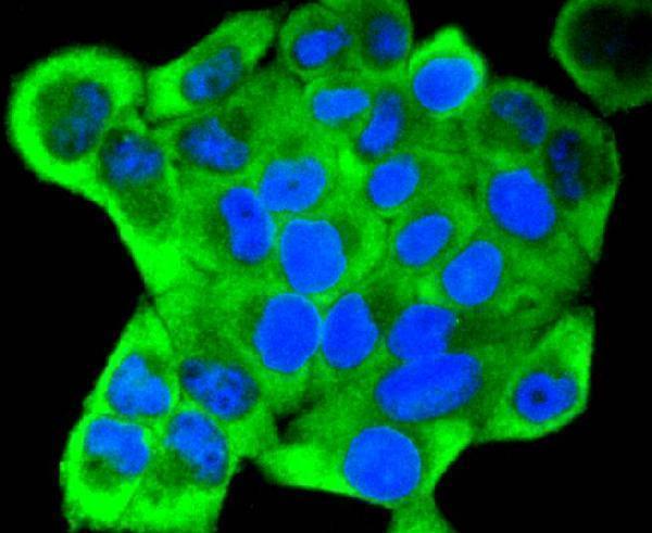 ICC staining Cytokeratin 18 in Hela cells (green)