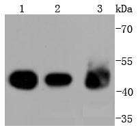 Western blot analysis of Cytokeratin 18 on different lysates using anti-Cytokeratin 18 antibody at 1/20,000 dilution
