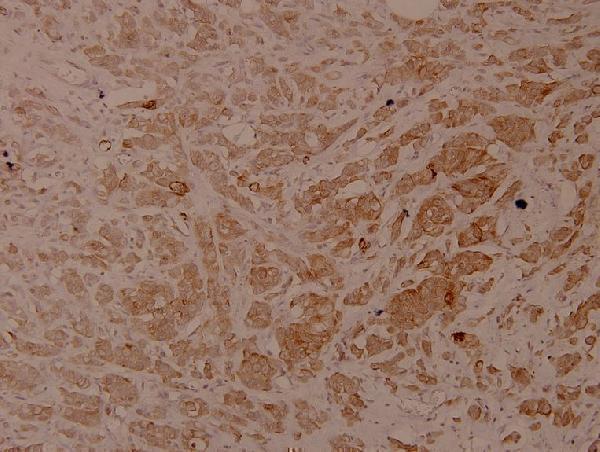a01357s33 krt18 primary antiboties ihc testing 2