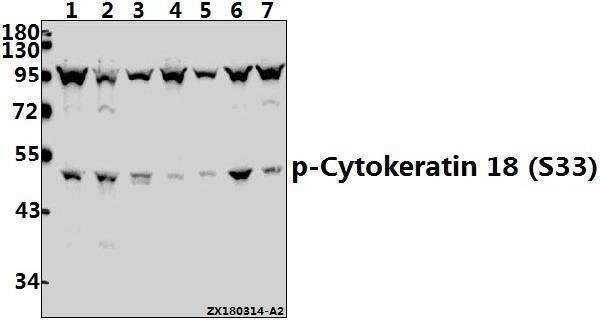 a01357s33 krt18 primary antiboties wb testing 1