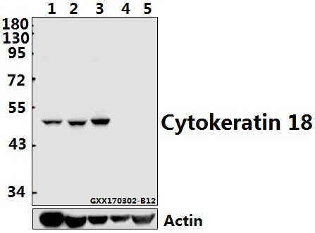 Western blot (WB) analysis of Cytokeratin 18 (S48) polyclonal antibody at 1:500 dilution
Lane1:HepG2 whole cell lysate(40ug)
Lane2:L02 whole cell lysate(40ug)
Lane3:A549 whole cell lysate(40ug)
Lane4:PC12 whole cell lysate(40ug)
Lane5:MEF whole cell lysate(40ug)