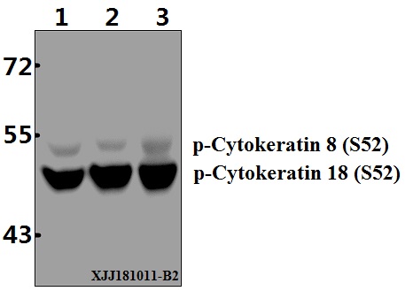 Western blot (WB) analysis of p-Cytokeratin 18 (S52) polyclonal antibody at 1:500 dilution
Lane1:HepG2 whole cell lysate(40µg)
Lane2:L02 whole cell lysate(40µg)
Lane3:A549 whole cell lysate(40µg)