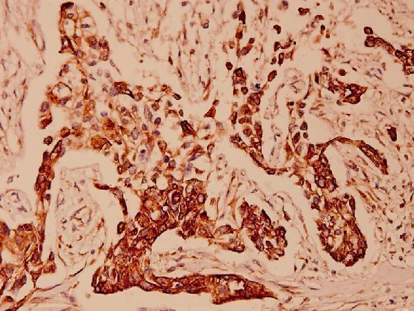 a01357t410 krt18 primary antiboties ihc testing 2
