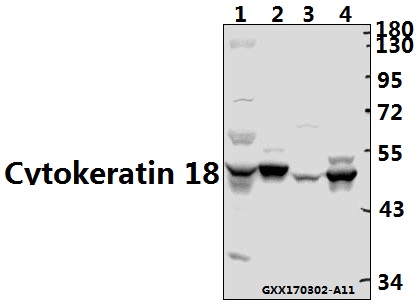 a01357t410 krt18 primary antiboties wb testing 1