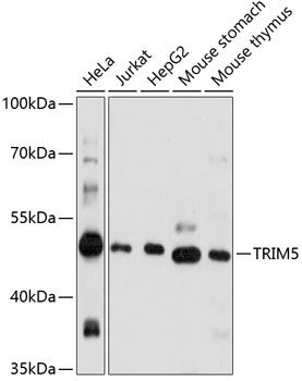 a01359 2 trim5 primary antiboties wb testing 1