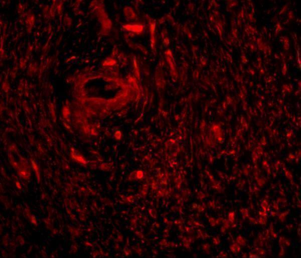 Immunofluorescence of TRIM5 gamma in human bladder tissue with TRIM5 gamma antibody at 20 μg/mL