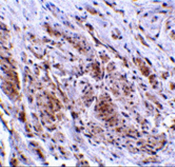 Immunohistochemistry of TRIM5 gamma in human bladder tissue with TRIM5 gamma antibody at 2 μg/mL