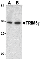 Western blot analysis of TRIM5 gamma expression in human bladder (A) and colon (B) cell lysate with TRIM5 gamma antibody at 2 μg/ml