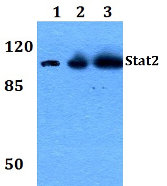 Western blot (WB) analysis of Stat2 (L684) polyclonal antibody at 1:500 dilution
Lane1:HEK293T whole cell lysate
Lane2:Raw264