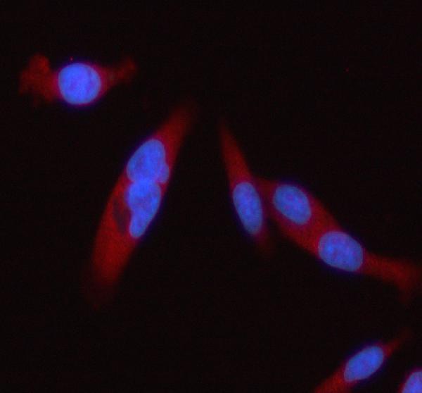 a01360 stat2 primary antibodies if testing 2