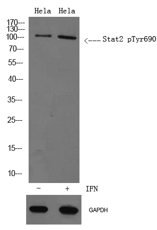 Western blot analysis of lysates from Hela cells treated with IFN 2500U/ml 30' , using Stat2 p-Thr690 Antibody