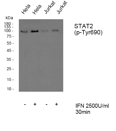 Western blot analysis of Stat2 (phospho Tyr690) Polyclonal Antibody, using Hela, Jurkat cell treated or untreated with IFN 2500U/ml 30