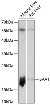 Western blot analysis of extracts of various cell lines, using SAA1 antibody  at 1:3000 dilution