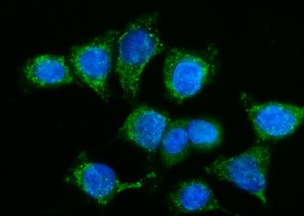 a01364 2 kiss1r primary antibodies if testing 8