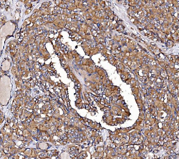a01364 2 kiss1r primary antibodies ihc testing 3