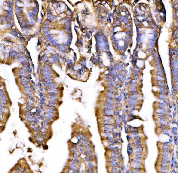 a01364 2 kiss1r primary antibodies ihc testing 5