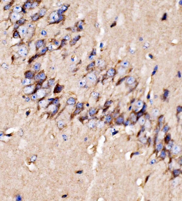 a01364 2 kiss1r primary antibodies ihc testing 6