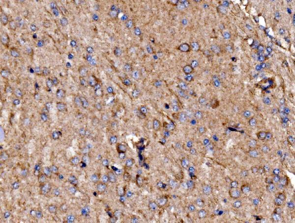 a01364 2 kiss1r primary antibodies ihc testing 7