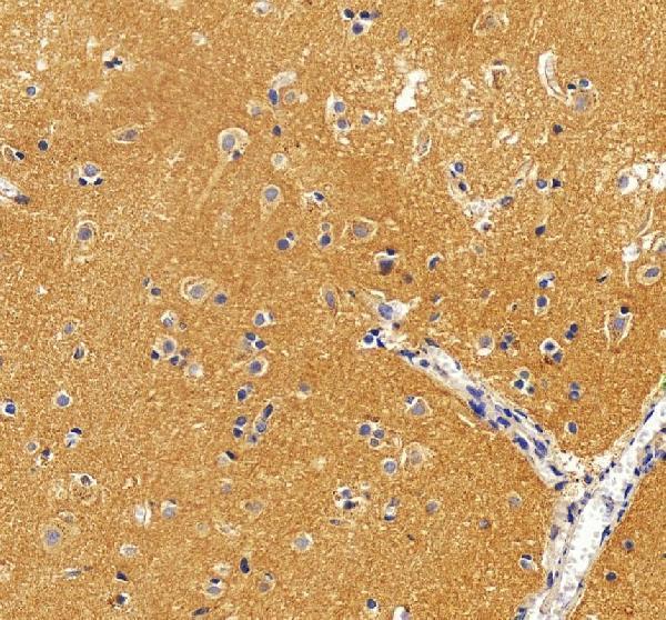 IHC analysis of KISS1R using anti-KISS1R antibody (A01364-2)