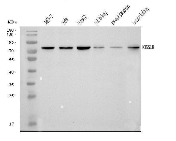  Western blot analysis of GPR54/KISS1R using anti-GPR54/KISS1R antibody (A01364-2)