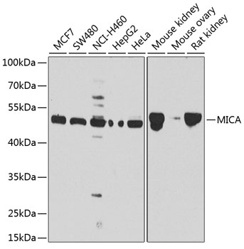 Western blot analysis of extracts of various cell lines, using MICA antibody  at 1:1000 dilution