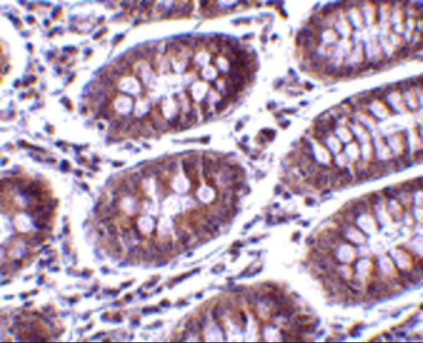 a01366 mica primary antibodies ihc testing 2