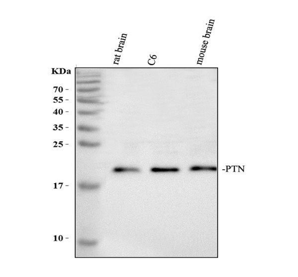 Western blot analysis of Pleiotrophin using anti-Pleiotrophin antibody (A01368-1)