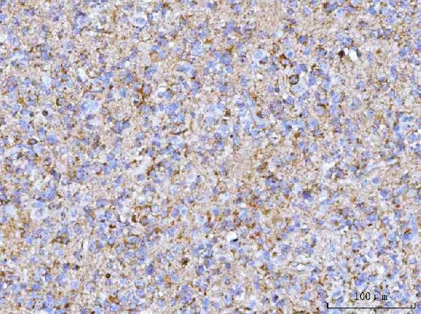  IHC analysis of PTN using anti-PTN antibody (A01368-2)