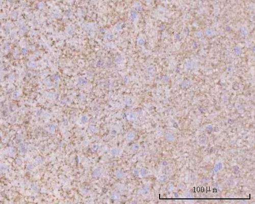  IHC analysis of PTN using anti-PTN antibody (A01368-2)