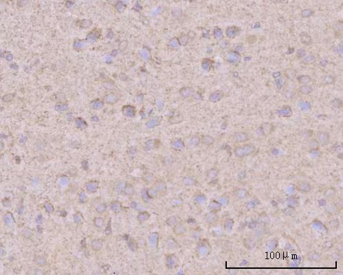 a01368 2 ptn primary antibodies ihc testing 4