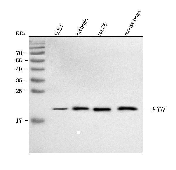  Western blot analysis of PTN using anti-PTN antibody (A01368-2)