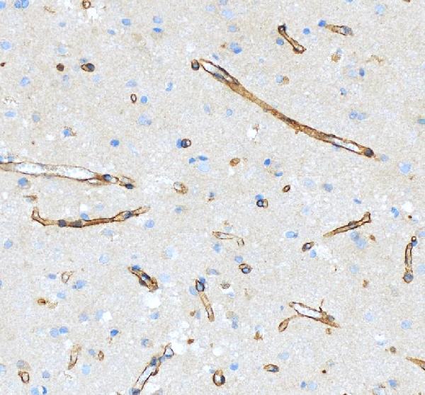 IHC analysis of Dystroglycan/DAG1 using anti-Dystroglycan/DAG1 antibody (A01369-1)