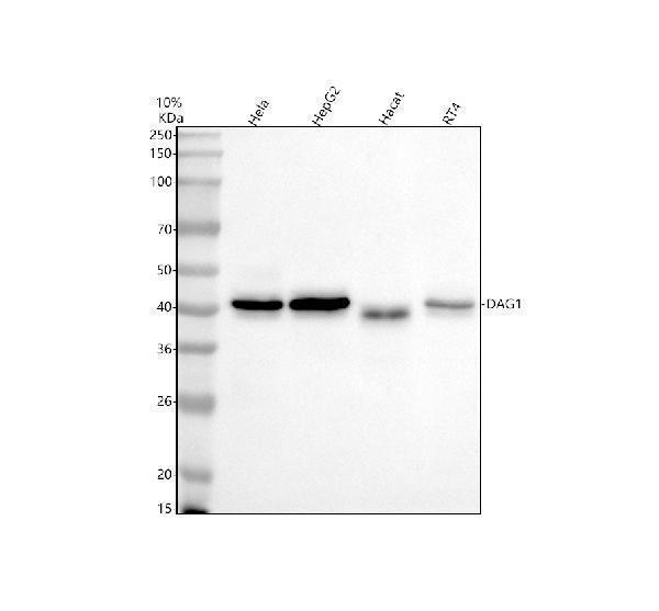  Western blot analysis of Dystroglycan/DAG1 using anti-Dystroglycan/DAG1 antibody (A01369-1)