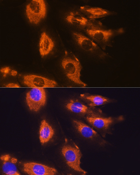 Immunoprecipitation analysis of 300ug extracts of Hela cells using 3ug DAG1 antibody 