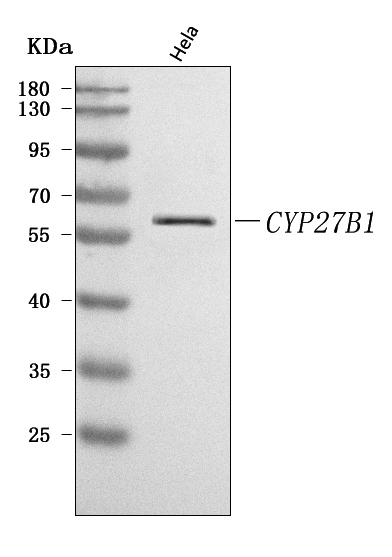  Western blot analysis of CYP27B1 using anti-CYP27B1 antibody (A01370)