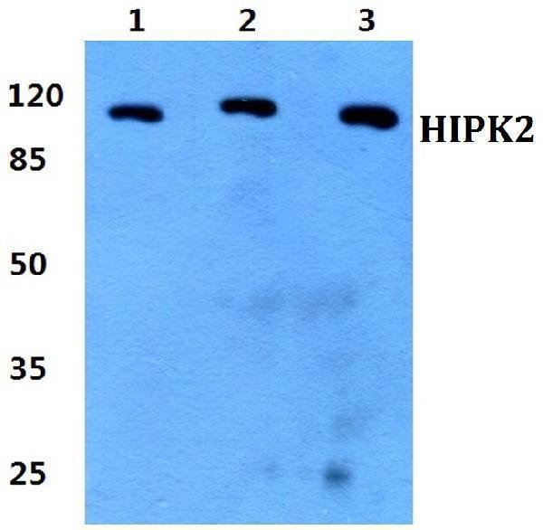 a01371 hipk2 primary antiboties wb testing 1