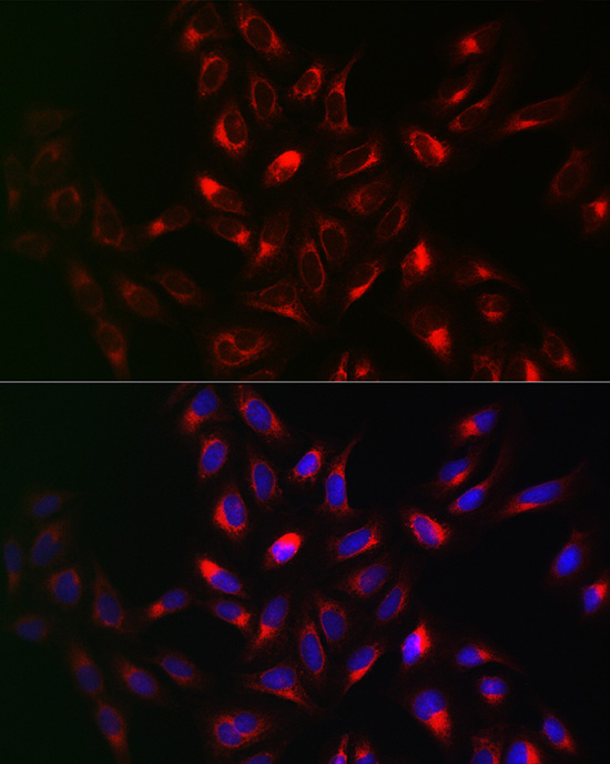 a01372 1 vapb primary antiboties if testing 4