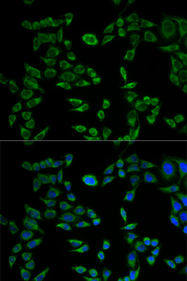 Immunohistochemistry of paraffin-embedded human esophageal cancer using VAPB Rabbit pAb  at dilution of 1:50 