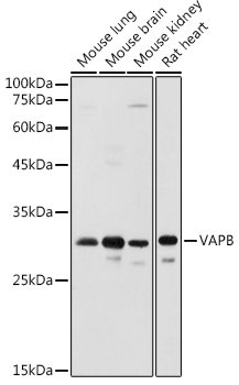Western blot analysis of extracts of various cell lines, using VAPB antibody  at 1:1000 dilution