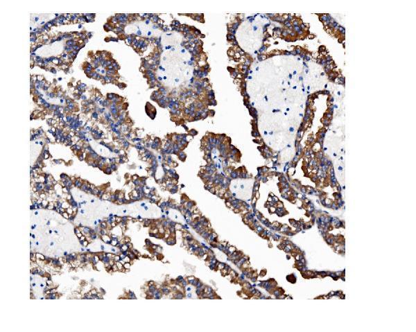 a01372 vapb primary antibodies ihc testing 3