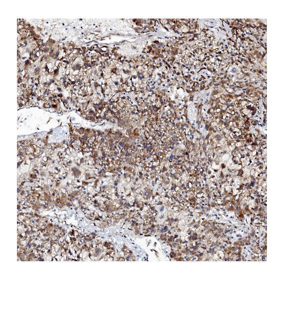 a01372 vapb primary antibodies ihc testing 4