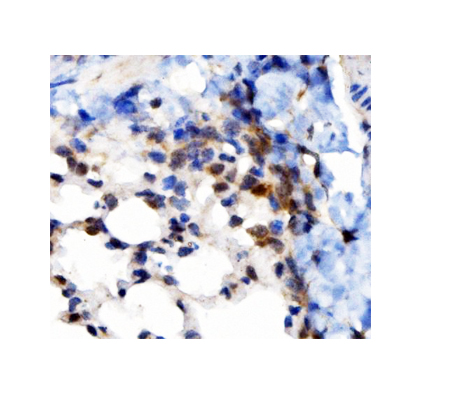 a01372 vapb primary antibodies ihc testing 5