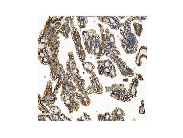 a01372 vapb primary antibodies ihc testing 6