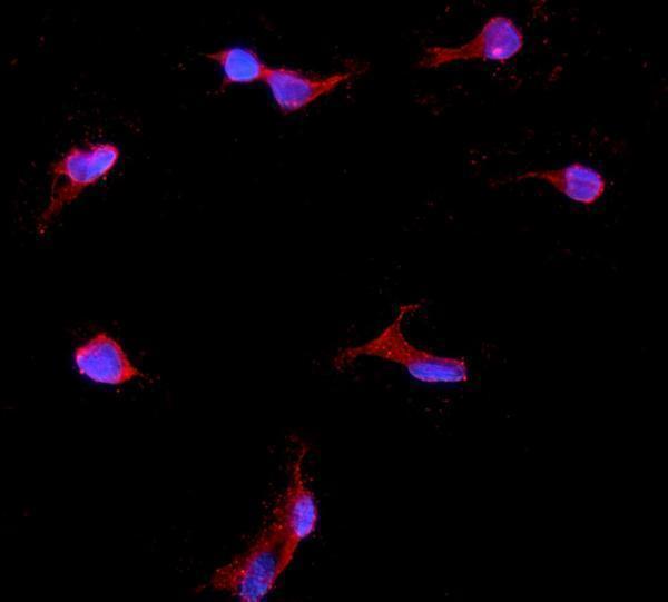 a01373 2 igfbp2 primary antibodies ihc testing 7