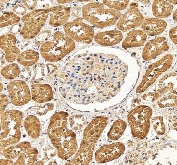 IHC analysis of DOPA decarboxylase/DDC using anti-DOPA decarboxylase/DDC antibody (A01374-2)