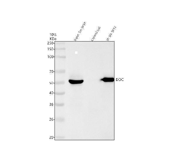  Immunoprecipitating (IP) DOPA decarboxylase/DDC in SH-SY5Y whole cell lysate