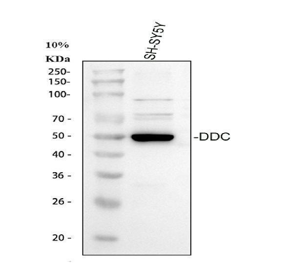  Western blot analysis of DOPA decarboxylase/DDC using anti-DOPA decarboxylase/DDC antibody (A01374-2)