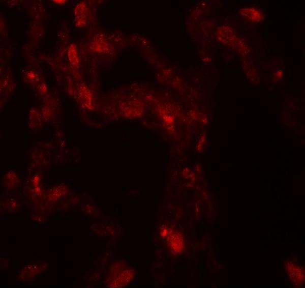 Immunofluorescence of DDC in human lung tissue with DDC antibody at 20 μg/mL